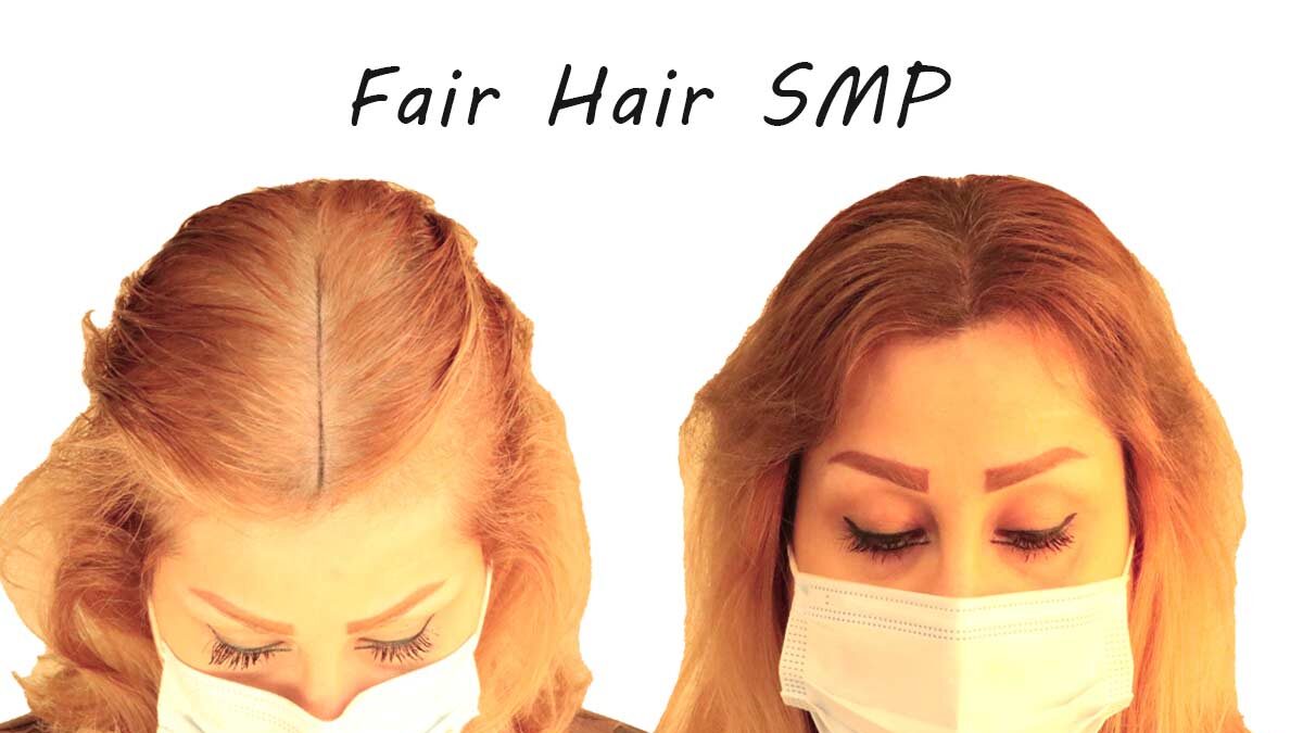 scalp micropigmentation for fair hair